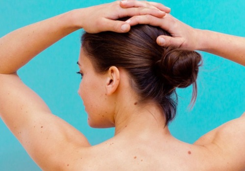 Diagnosing Skin Cancer: What You Need to Know